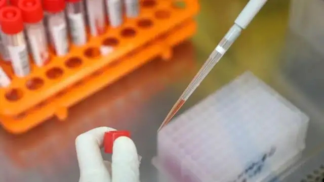 超温贮存采样管 北京顺义一检测机构被处罚