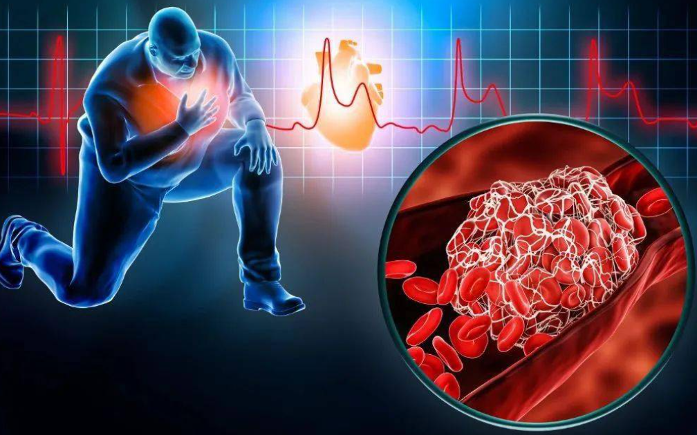 【健康科普】动起来，别栓住，远离血栓君