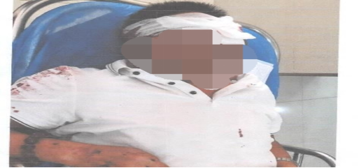 永吉法院：同学聚会起冲突，酒后打架致判刑