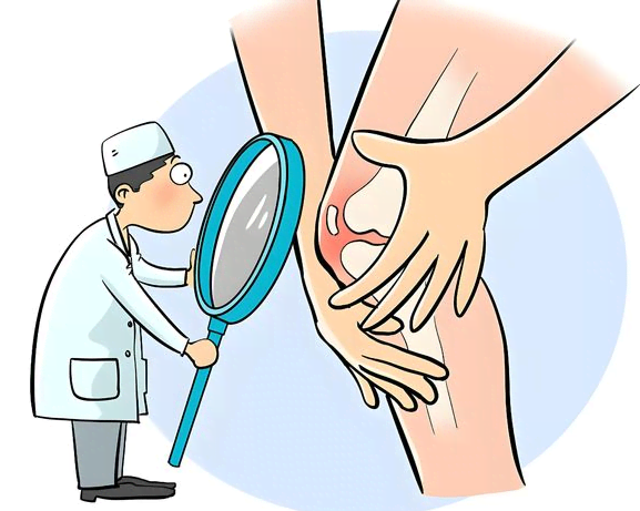 卡路里大战 别让膝盖先“投降”！
